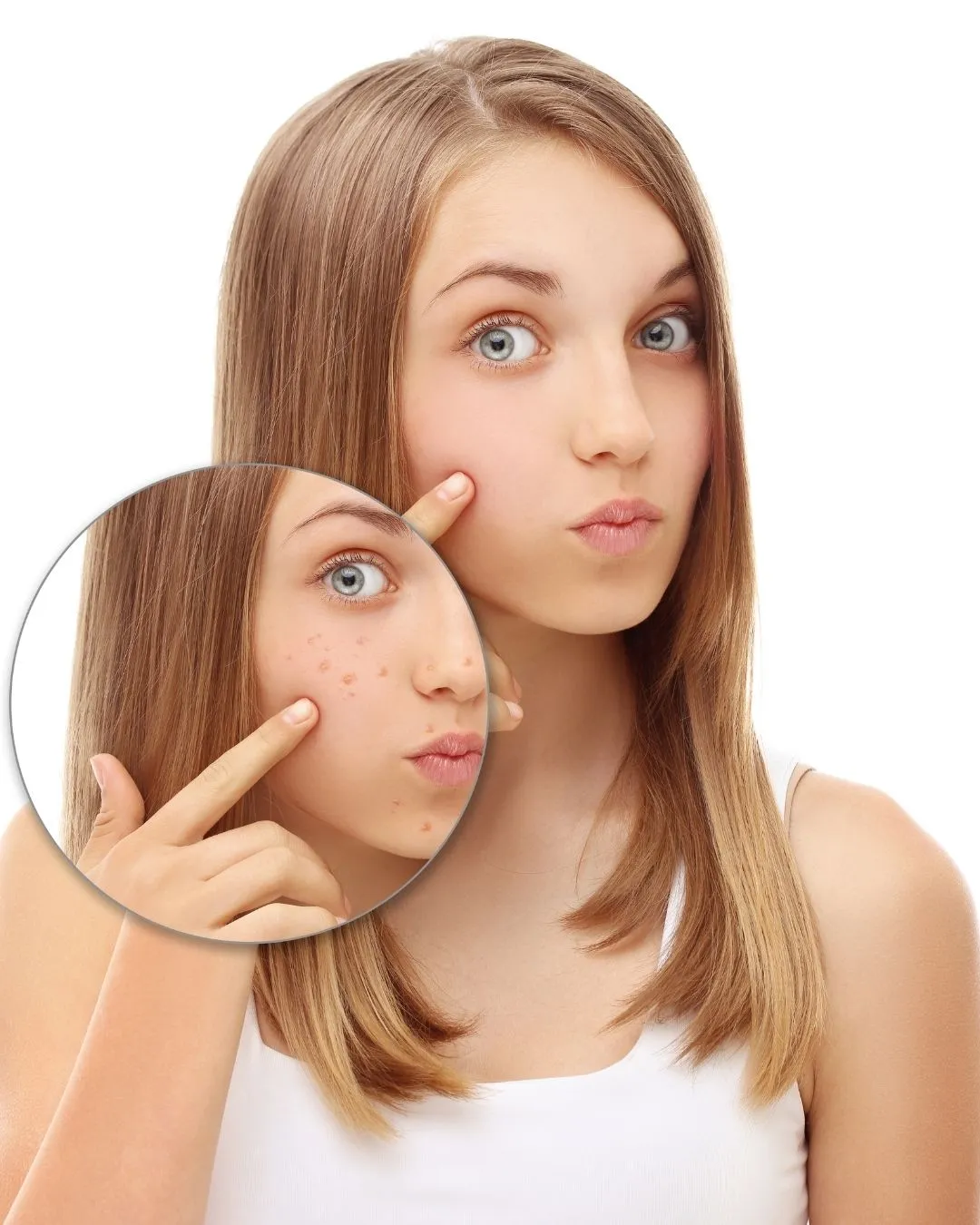 Hautcoaching für Jugendliche