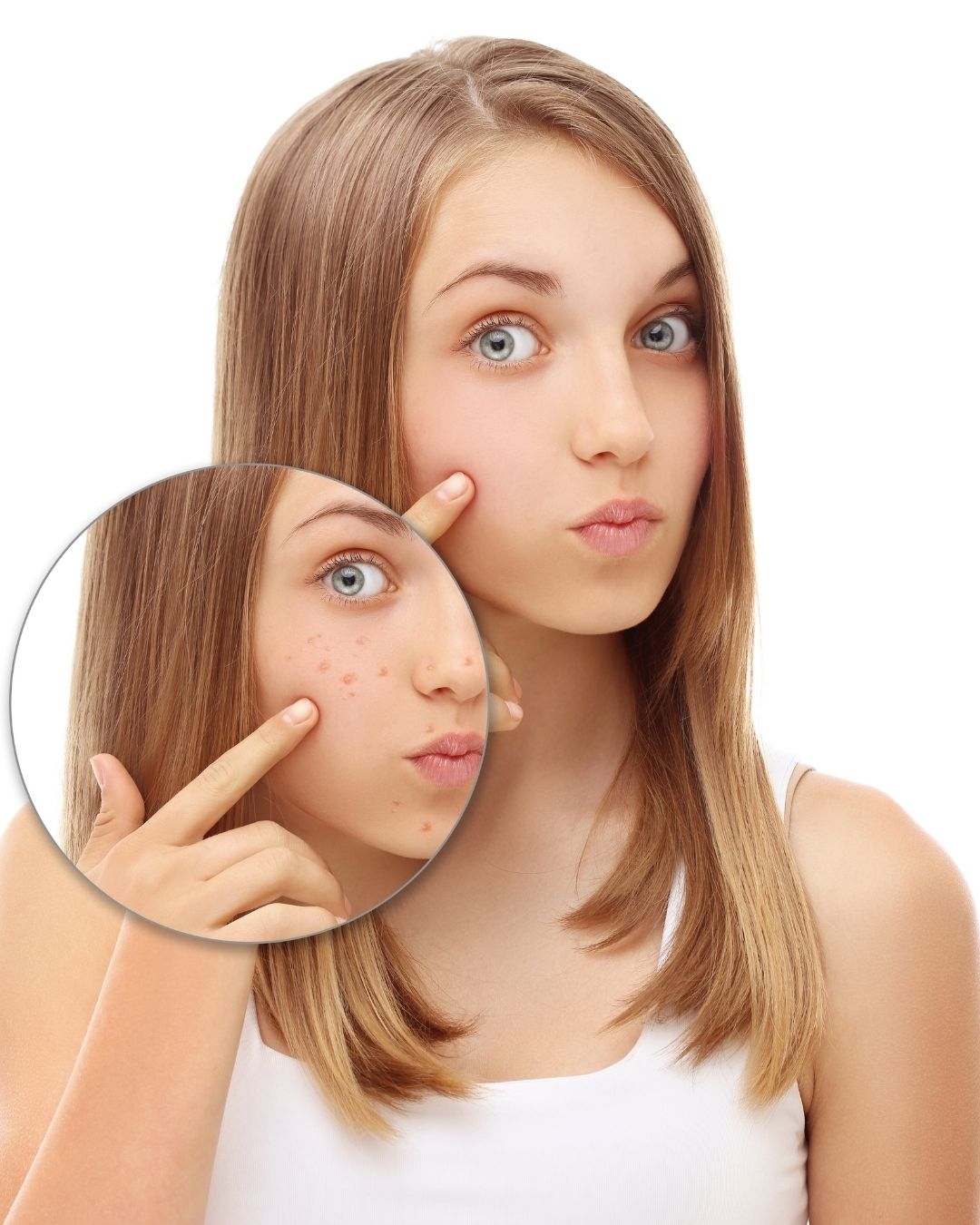Hautcoaching für Jugendliche