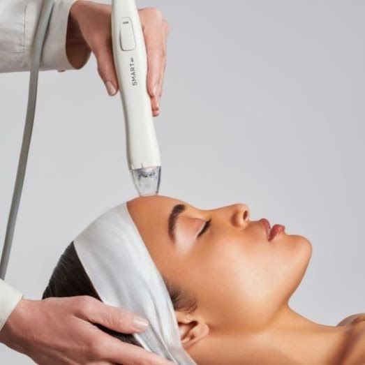 Microneedling