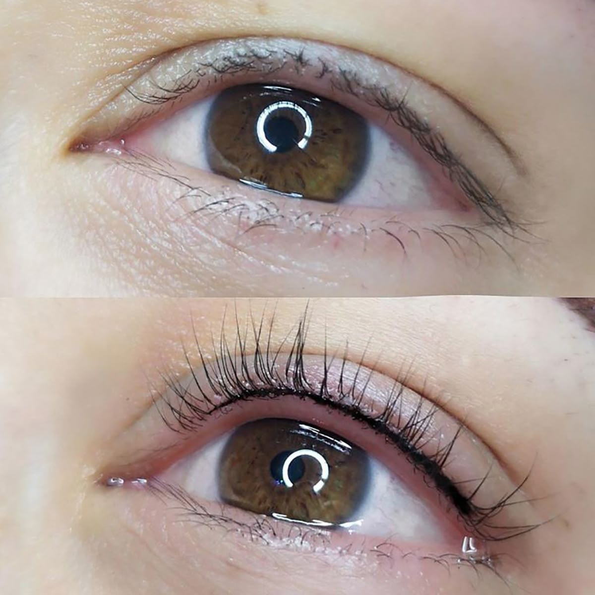 Wimpernkranzverdichtung